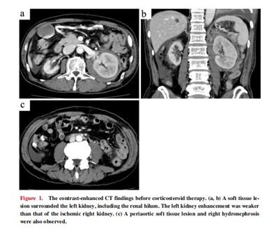 Figure 1 Figure 1