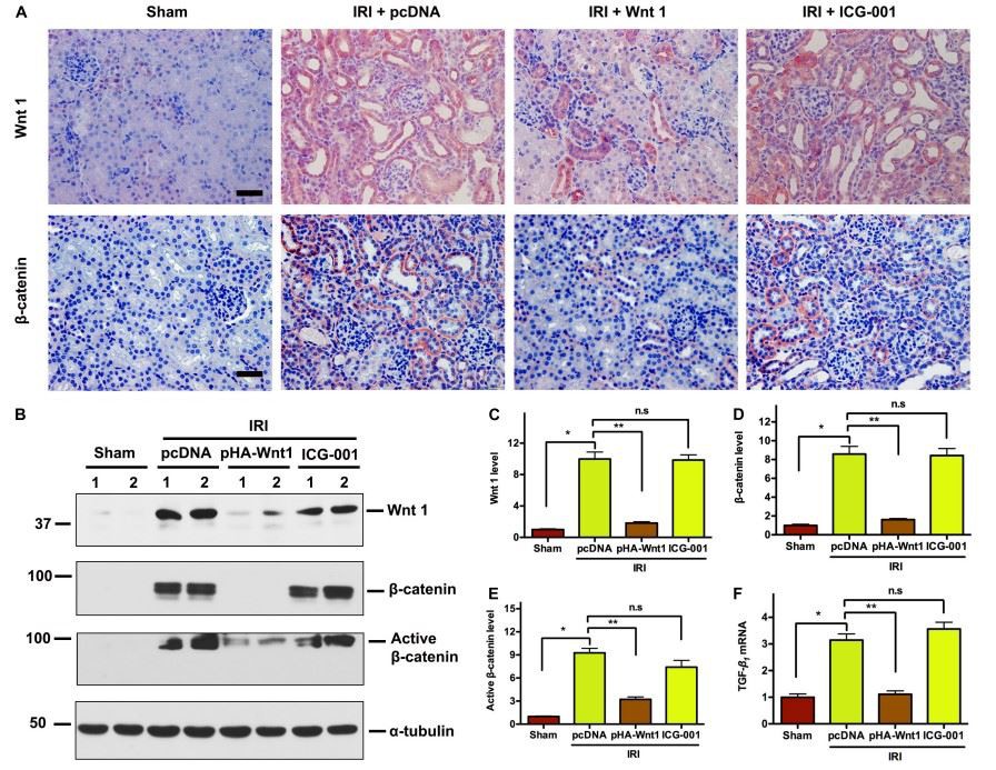 FIGURE 4 | In vivo expression of exogenous Wnt1 before IR down-regulates endogenous Wnt1 and β-catenin in kidneys of mice after AKI-CKD progression