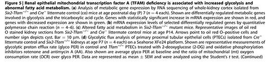 cistanches is good for polycystic kidney disease