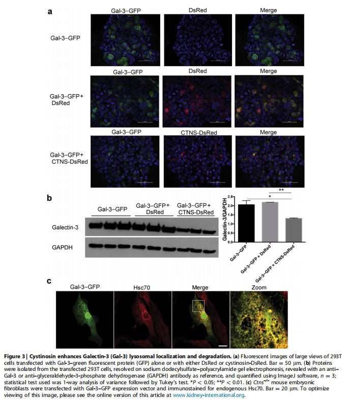 Cystinosin enhances Galectin-3 (Gal-3) lysosomal localization and degradation. (
