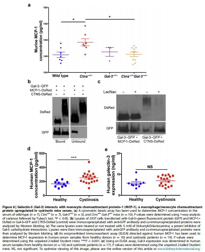  Galectin-3 (Gal-3) interacts with monocyte chemoattractant protein–1 (MCP-1), a macrophage/monocyte chemoattractant protein upregulated in cystinotic mice serum.