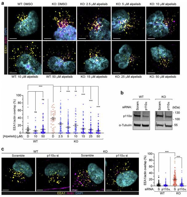 Lowe syndrome/Dent disease