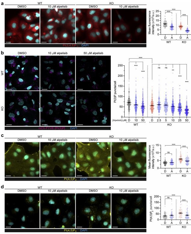 Lowe syndrome/Dent disease