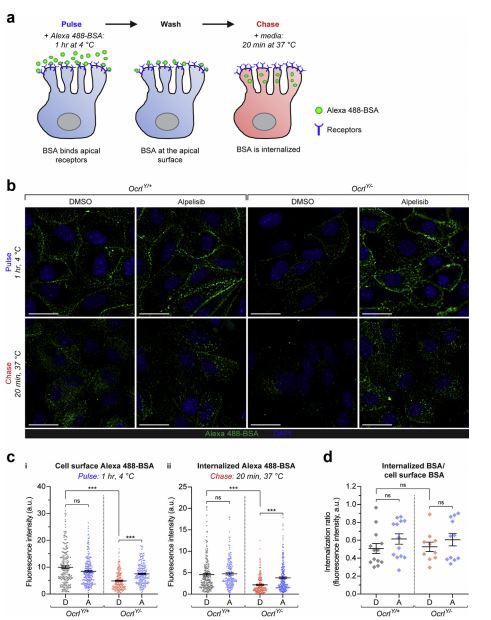 Lowe syndrome/Dent disease