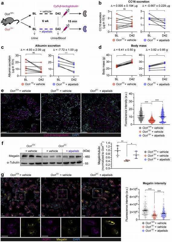 Lowe syndrome/Dent disease