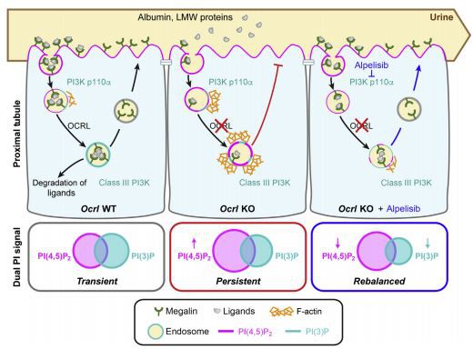 Lowe syndrome/Dent disease