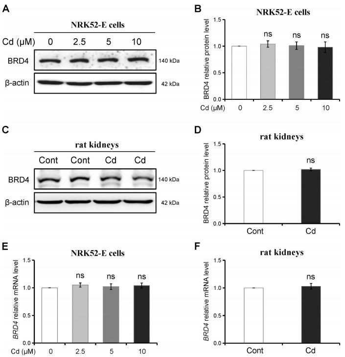 Fig. 3. Cd did not affect BRD4 transcription and protein expression levels. Fig. 3. Cd did not affect BRD4 transcription and protein expression levels.