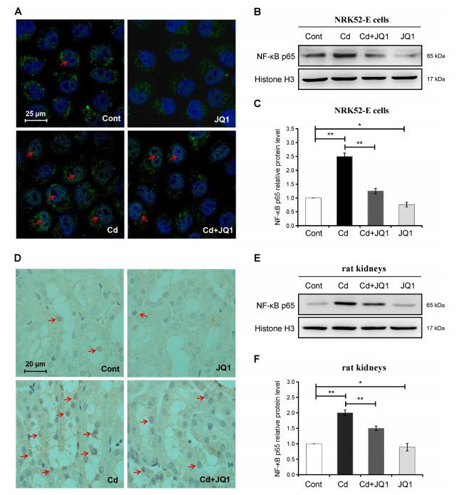 Fig. 4. Inhibition of BRD4 reduces Cd-promoted NF-κB nuclear translocation. Fig. 4. Inhibition of BRD4 reduces Cd-promoted NF-κB nuclear translocation.
