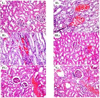 gure 1. Histopathological findings of rat kidney protection by A. hierochuntica extracts (Hematoxylin-Eosin (HE), 200X). Histopathological nephrotoxicity induction. G gure 1. Histopathological findings of rat kidney protection by A. hierochuntica extracts (Hematoxylin-Eosin (HE), 200X). Histopathological nephrotoxicity induction. G