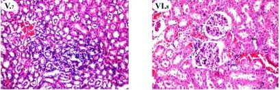 gure 1. Histopathological findings of rat kidney protection by A. hierochuntica extracts (Hematoxylin-Eosin (HE), 200X). Histopathological nephrotoxicity induction. G gure 1. Histopathological findings of rat kidney protection by A. hierochuntica extracts (Hematoxylin-Eosin (HE), 200X). Histopathological nephrotoxicity induction. G