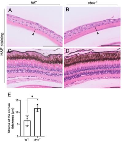 Cistanche-kidney