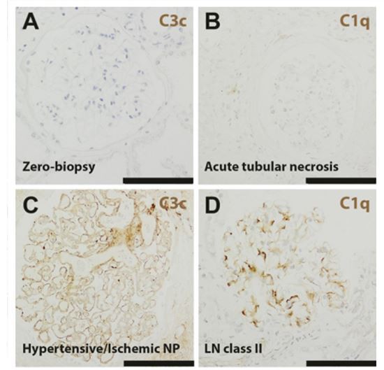 figure 3-1 Cistanche can treat renal disease