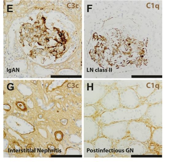 figure 3-2 Cistanche can treat renal disease