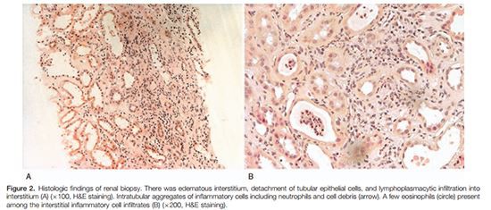 Cistanche can treat nephritis