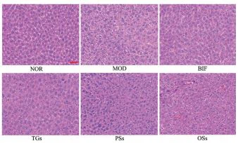 Figure 2 Effects of extracts of C. deserticola Y. C. Ma on histo‐ pathological changes of liver in alcoholic liver injury mice. n = 5. Scale bar = 100 μm
