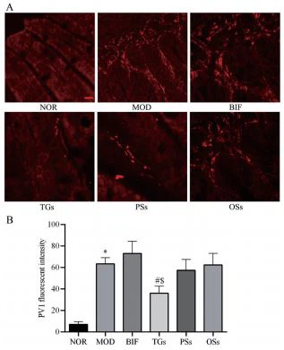 Figure 7 Effects of extracts of C. deserticola Y. C. Ma on the expression of plasmalemma vesicle-associated protein-1 (PV1) in alcoholic liver injury mice. A: Immunofluorescence staining of small intestine sections; B: Bar graph showed a quantification of the expression of PV1. *P < 0.05 vs NOR; #P < 0.05 vs MOD; $P < 0.05 vs BIF. n = 3, -x ± s. Scale bar = 100 μm