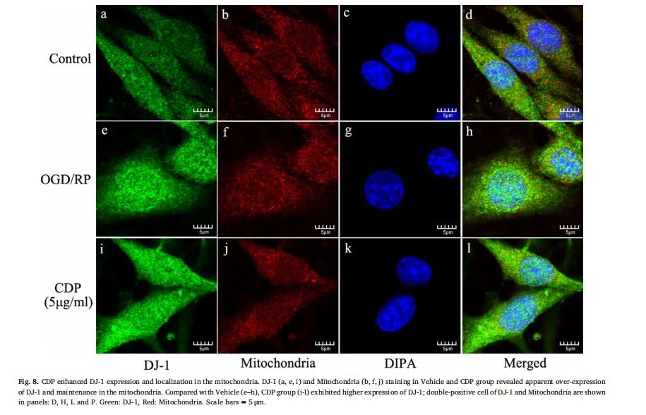 image-Cistanche deserticola polysaccharides have a Neuroprotective effect