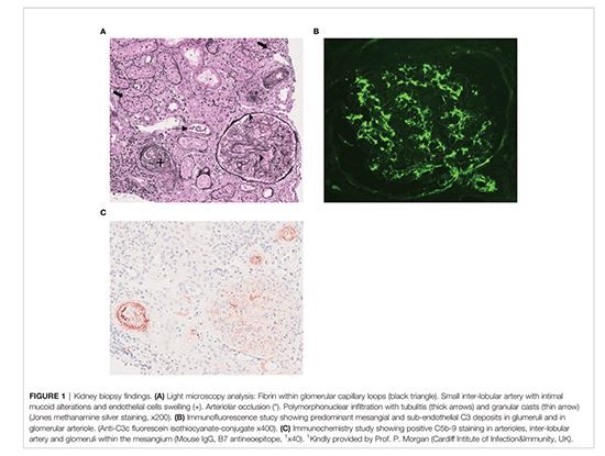 Cistanche has a good effect of improving immunity