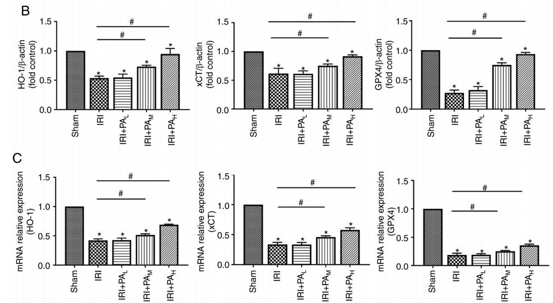 ischemia reperfusion injur ischemia reperfusion injur