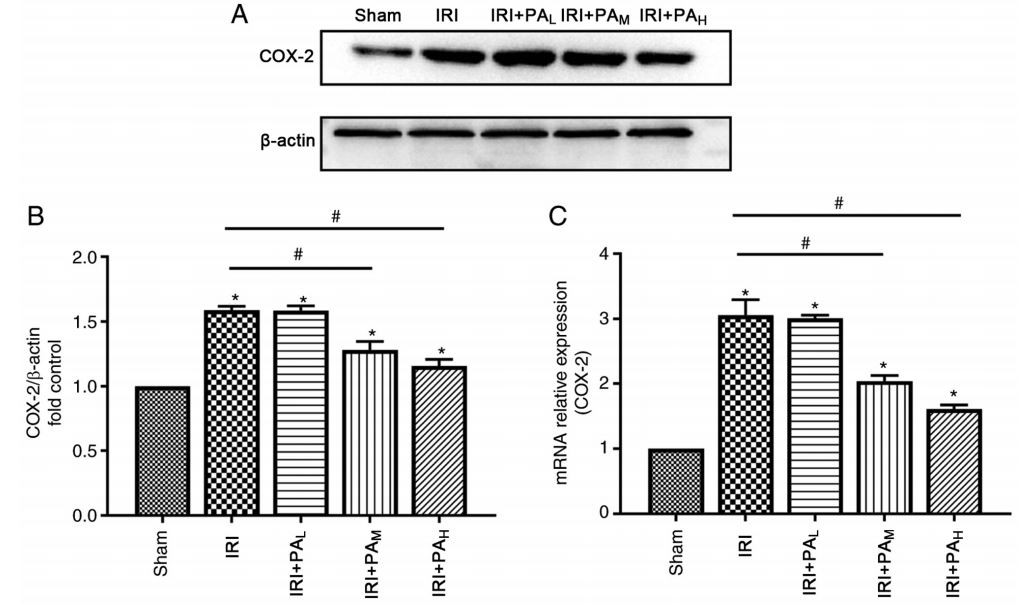 Effects of Pachymic acid on renal injury Effects of Pachymic acid on renal injury