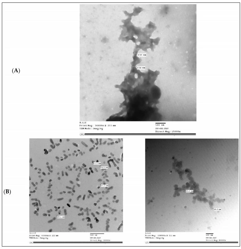 Transmission electron microscopy of (A) MP; (B) IHM; (C) NabM; (D) MP/IHM; and (E) MP/NabM. MP: milk proteins concentrate; MP/NabM: milk proteins/Nabeq mucilage complex; MP/IHM: milk proteins/Isabgol husk mucilage complex.
