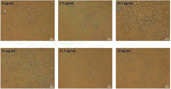 Figure 1 HepG2 cells treated with different concentrations of TG for 24 h (200x) Figure 1 HepG2 cells treated with different concentrations of TG for 24 h (200x)