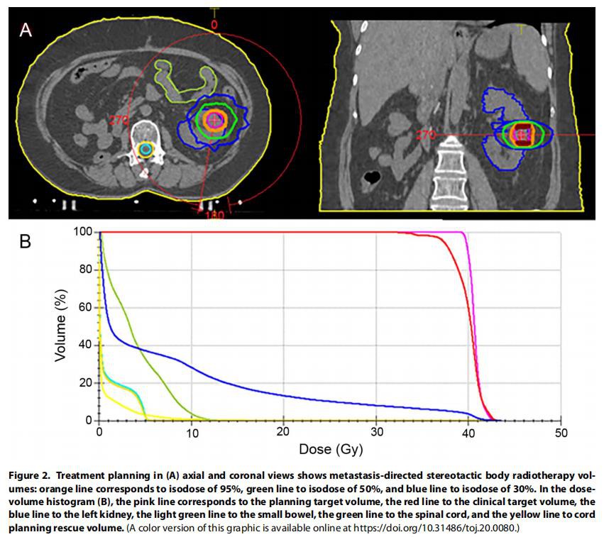 cistanche side effects reddit
