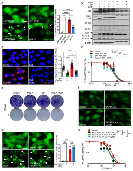 Figure 4. Cathepsin inhibition or calcium chelation does not prevent DC661-induced cell death. (A) Figure 4. Cathepsin inhibition or calcium chelation does not prevent DC661-induced cell death. (A)