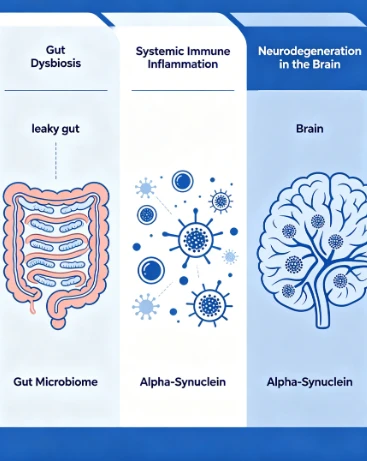 Gut-Immune-Brain Axis & Parkinson’s Disease: Natural Neuroprotective Support ...
