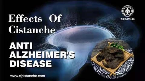 Anti Alzheimers 14 Anti Alzheimers 14